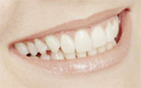 Estetica dentale